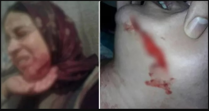 تلميذ يعتدي على أستاذته بالسلاح الأبيض