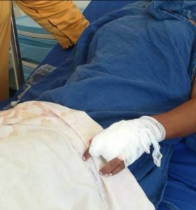 بتر أصبع تلميذة بمؤسسة بعين حرودة يثير الجدل