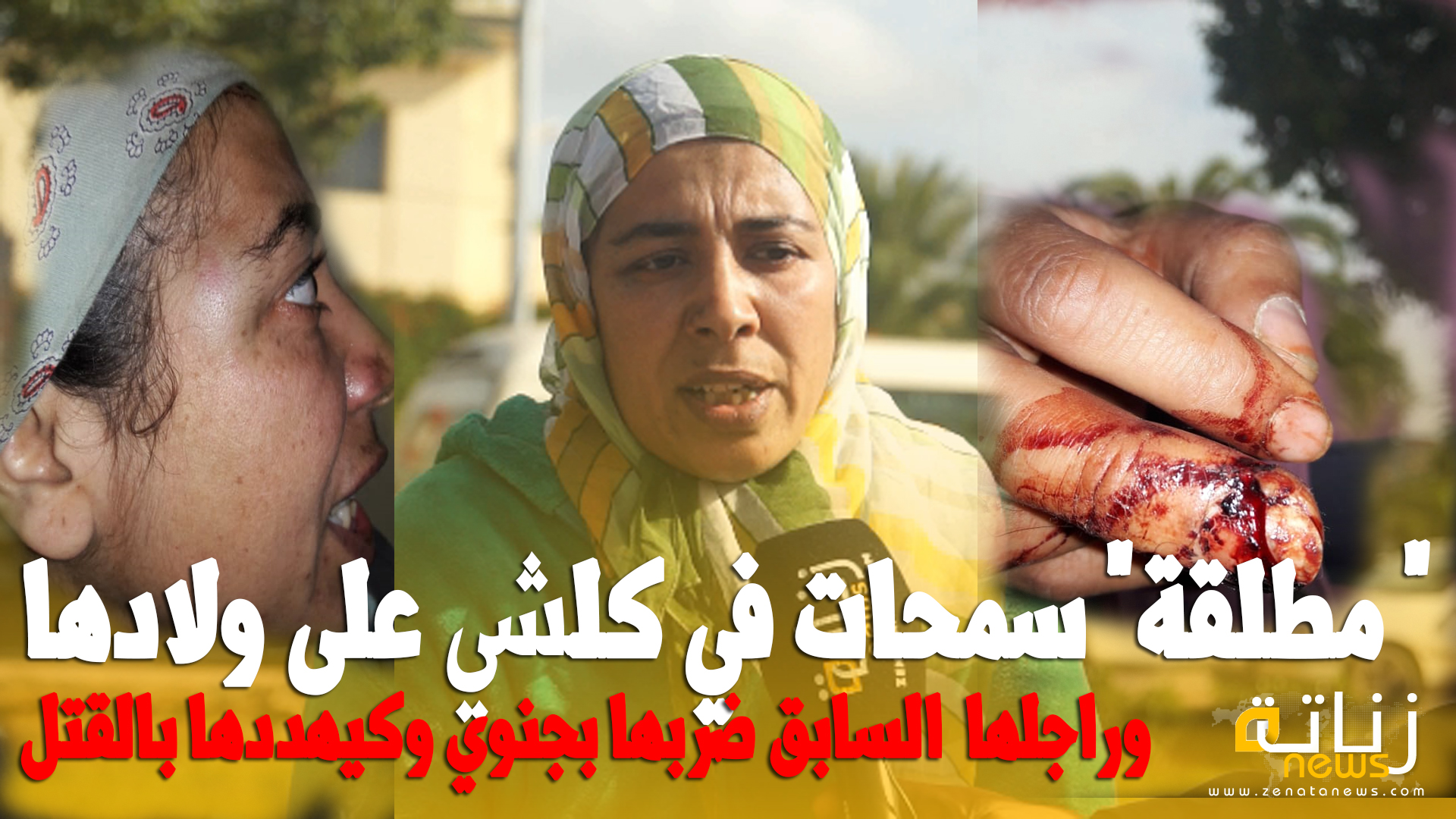 "مطلقة" سمحات في كلشي على ولادها وراجلها السابق ضربها بجنوي وكيهددها بالقتل