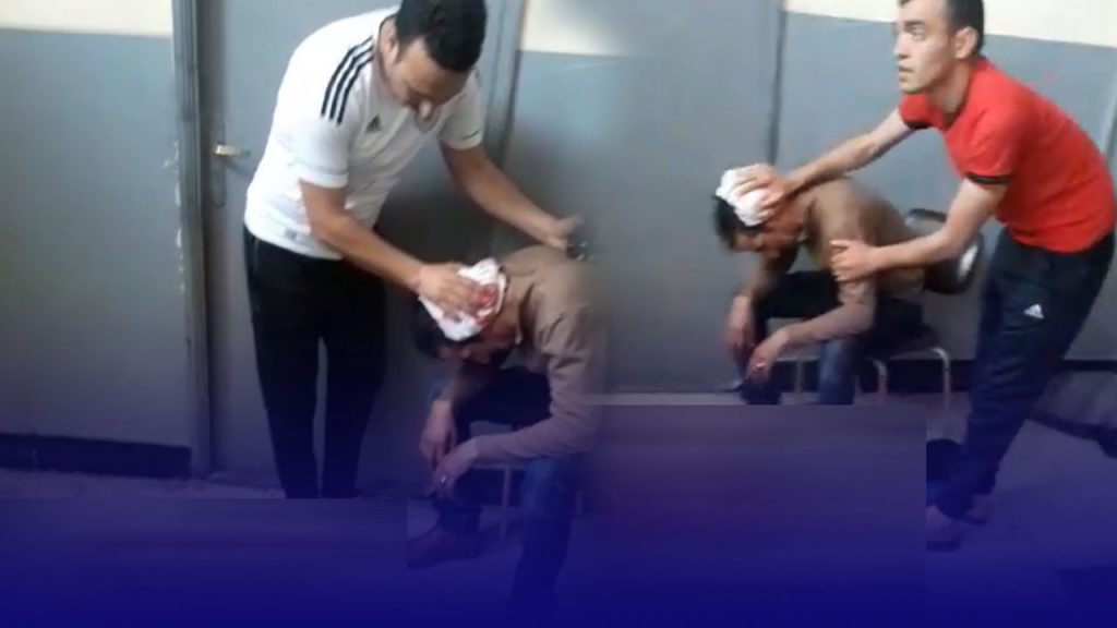 ترمضينة خايبة بالمحمدية  ضربو بحديدة للراس وخلاه طايح كلو دم وسط المقاطعة