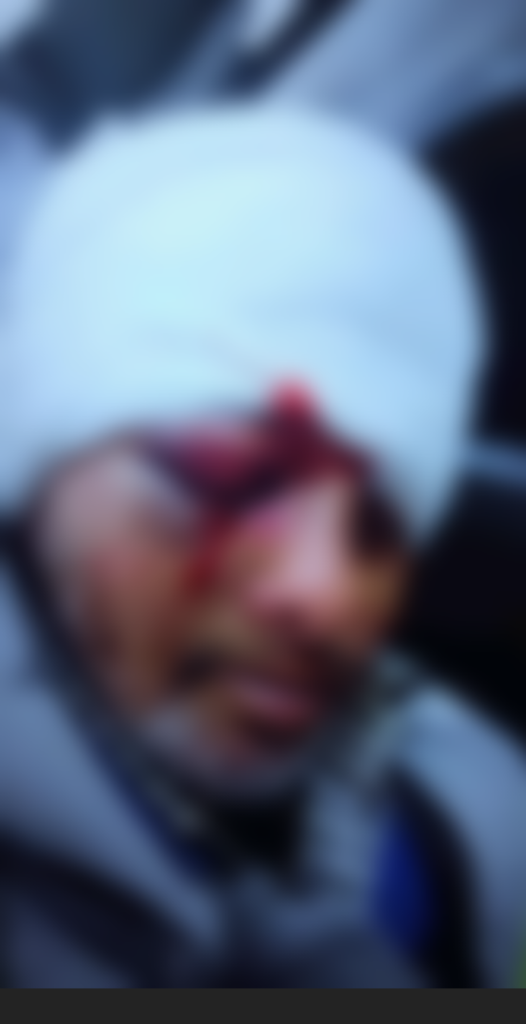 صرخة رواد التواصل الاجتماعي من عين حرودة: العدالة لعزيز، ضحية الاعتداء الذي أثر في قلوب الجميع!